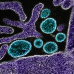 nipah-virus-symptoms