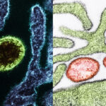 nipa-virus-health-emergency