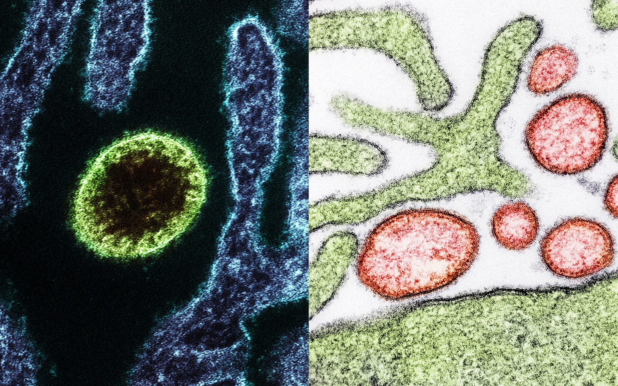 nipa-virus-health-emergency